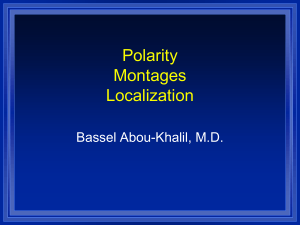 Polarity Montages Localization