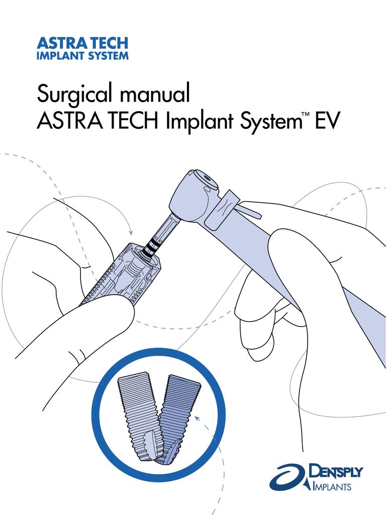 Astra Tech Implant System EV Ball Abutment EV