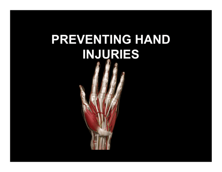 preventing-hand-injuries