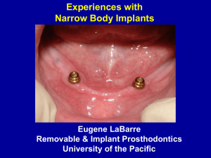 Experiences with Narrow Body Implants