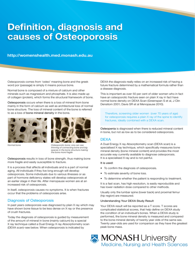 definition-diagnosis-and-causes-of-osteoporosis