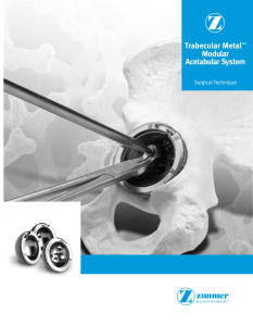 Trabecular Metal™ Modular Acetabular System