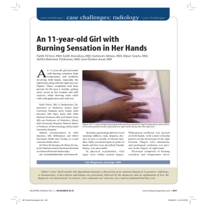 An 11-year-old Girl with Burning Sensation in Her Hands