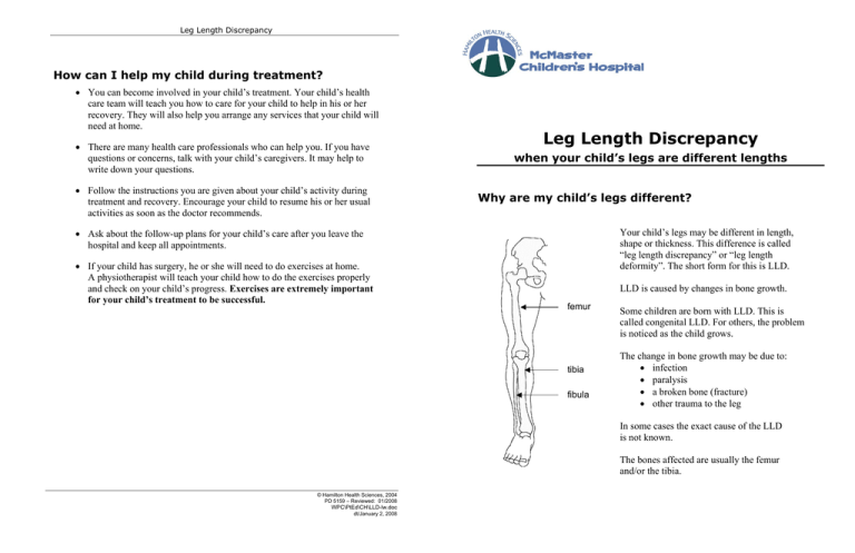 Leg Length Discrepancy - Hamilton Health Sciences