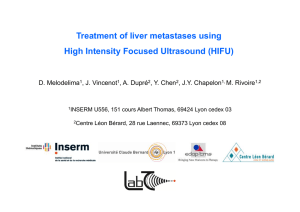 Treatment of liver metastases using High Intensity Focused