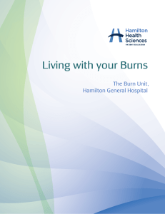 Living with your burns - Hamilton Health Sciences