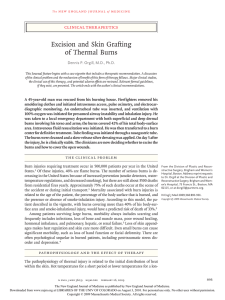 Excision and Skin Grafting of Thermal Burns