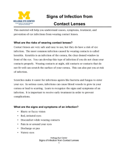 Signs of Infection from Contact Lenses