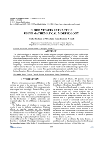 blood vessels extraction using mathematical