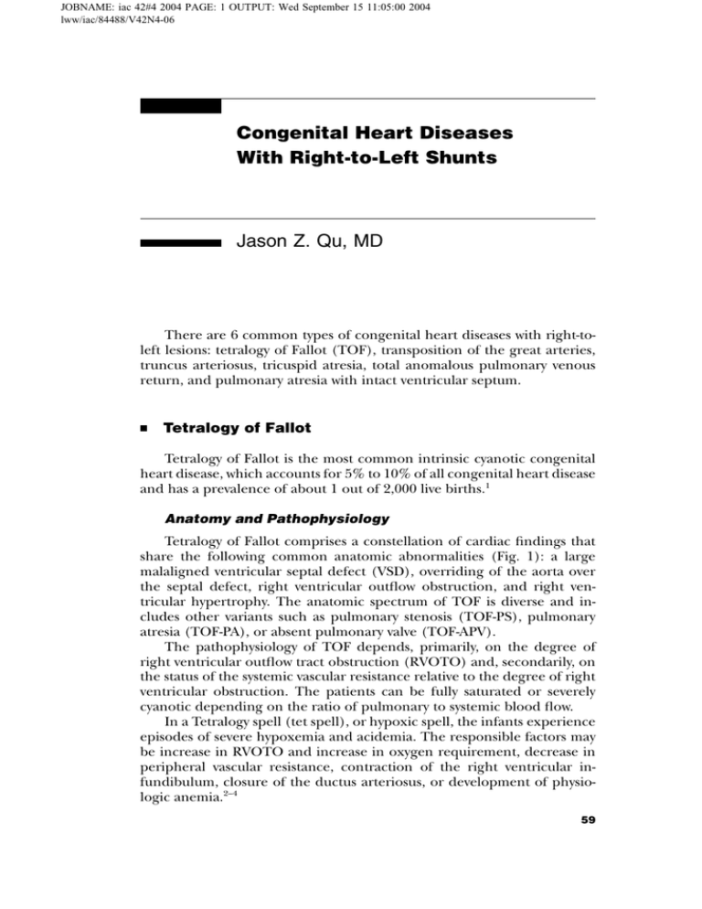 congenital heart disease essay
