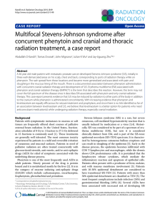 Multifocal Stevens-Johnson syndrome after
