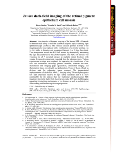 In vivo dark-field imaging of the retinal pigment epithelium cell mosaic