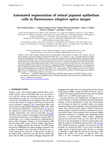 Automated segmentation of retinal pigment epithelium cells in