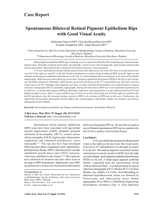 Spontaneous Bilateral Retinal Pigment Epithelium Rips with Good