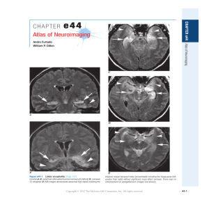 CHAPTER e44 Atlas of Neuroimaging - McGraw