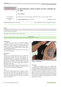 Lichenoid reactions in red tattoo: report of 2 cases