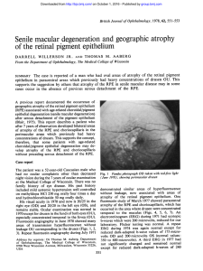 Senile macular degeneration and geographic atrophy