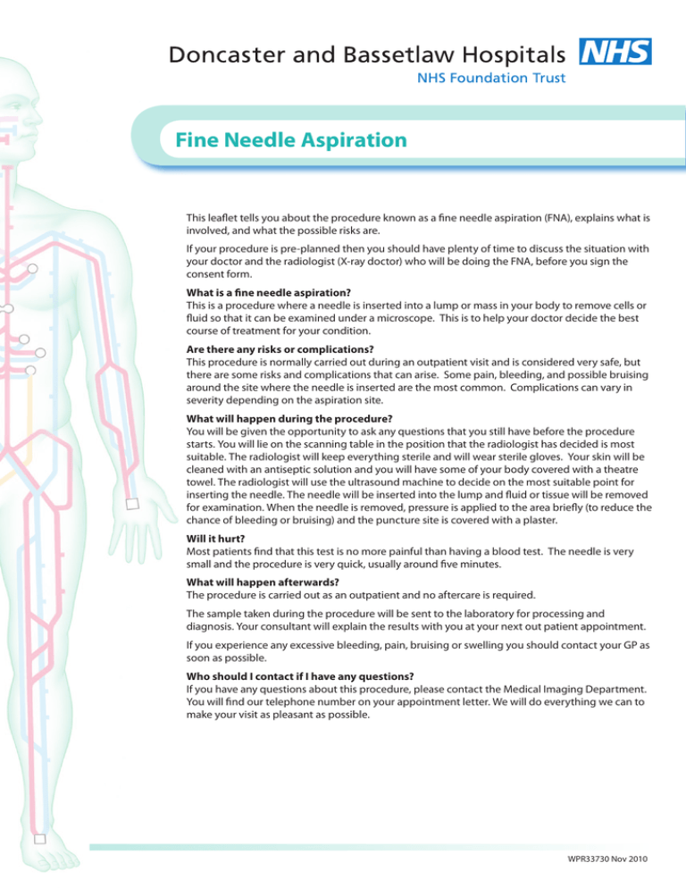 Fine Needle Aspiration