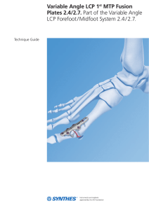 Variable Angle LCP 1st MTP Fusion Plates 2.4/2.7. Part of the