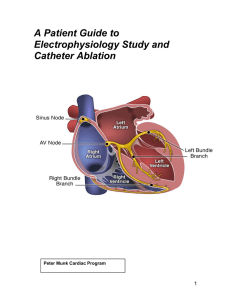 Electrophysiology Study and Catheter Ablation