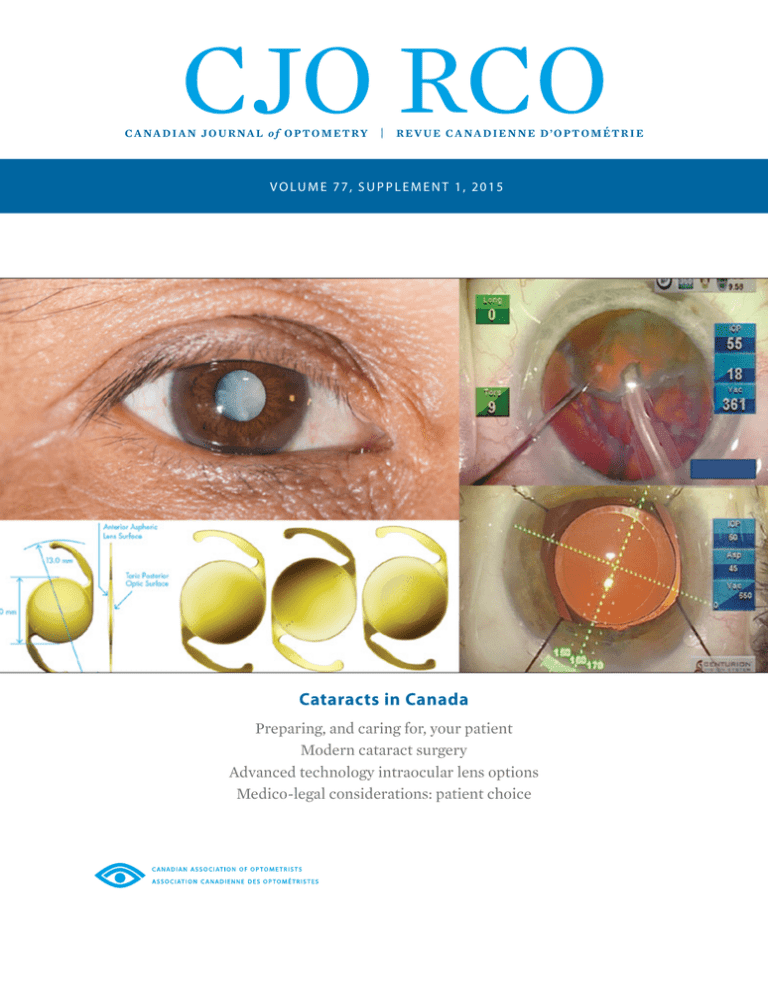 Cataracts In Canada The Canadian Association Of Optometrists