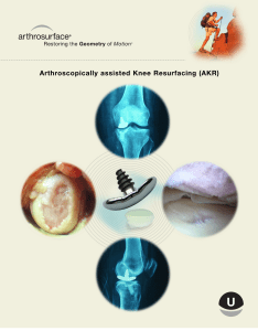 Arthroscopically assisted Knee Resurfacing (AKR)