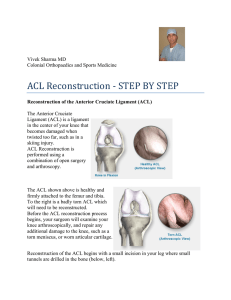 ACL Reconstruction ‐ STEP BY STEP