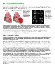 dilated cardiomyopathy - American Stroke Association