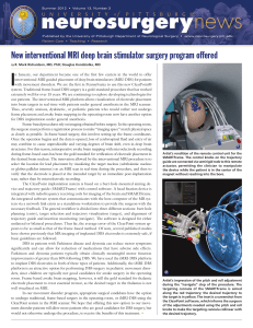 New interventional MRI deep brain stimulator surgery program offered