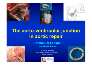The AV junction in aortic repair