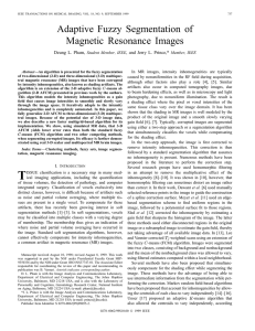 Adaptive fuzzy segmentation of magnetic resonance