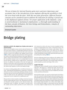 Bridge plating - AO Foundation