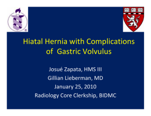 Hiatal Hernia with Complications of Gastric Volvulus
