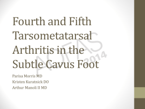 Fourth and Fifth Tarsometatarsal Arthritis in the Subtle Cavus Foot