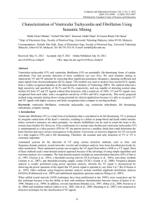 Characterization of Ventricular Tachycardia and Fibrillation Using