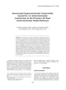 Paroxysmal Supraventricular Tachycardia Caused by 1 - Af