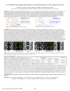 In Vivo Diffusion Tensor Imaging of Human Optic Nerve Using 2D