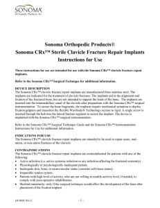 Sonoma CRx™ Sterile Clavicle Fracture Repair Implants