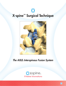 X-spine™ Surgical Technique - X