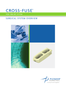 Cross-Fuse Surgical Overview
