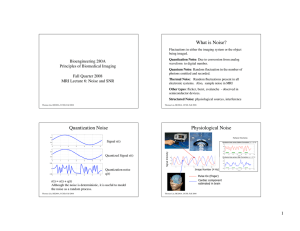 What is Noise? Quantization Noise Physiological Noise