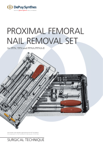 Femoral Nail Removal (Synthes)