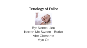 Tetralogy of Fallot Student