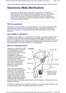 vasectomy leaflet
