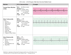 EKG Flash Chart(2)