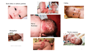 newbornSlide skin birth marks