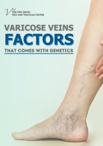 Does Genetics Play a Role in Varicose Veins