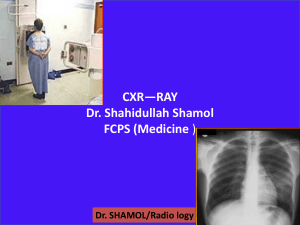 cxr abc by dr shamol-1