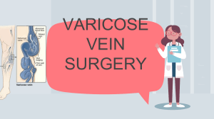 varicose vein surgery 