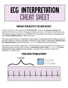 ECG Interpretation Cheat Sheet